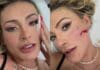 Andressa Urach com o rosto sangrando