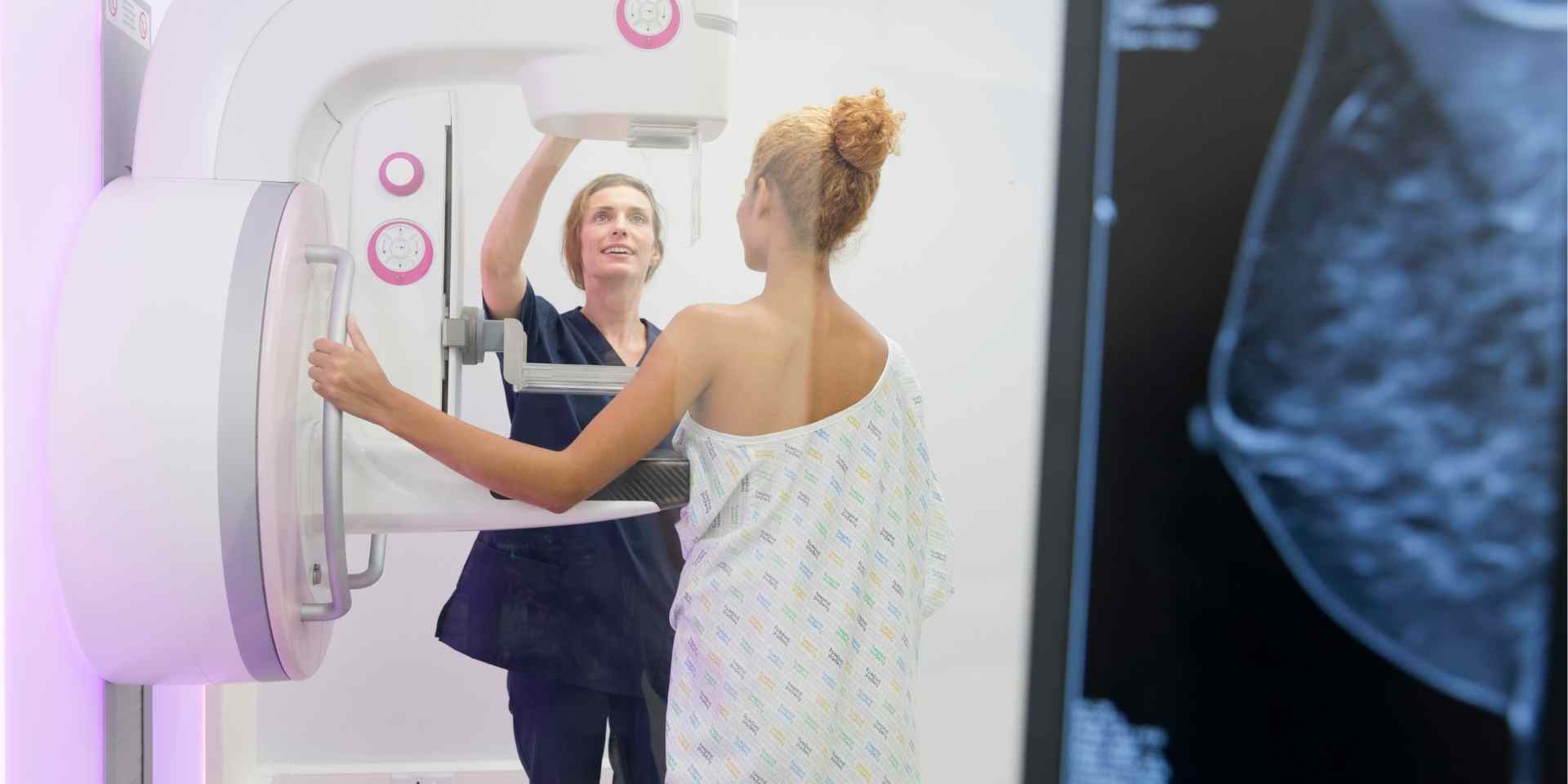 BH amplia oferta de mamografias em 164%; veja como acessar pelo SUS